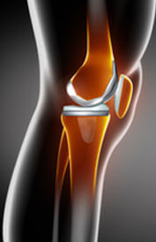 Research on Initial Stability in Cemented and Uncemented Tibial Baseplates in Total Knee Arthroplasty, Accepted to the Journal of Arthroplasty